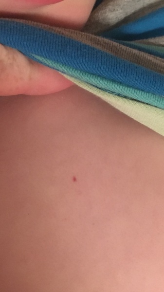 I have health anxiety so please help (photo)