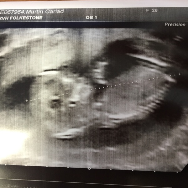 April 2017 #3 - looking forward to first scans and the second trimester!