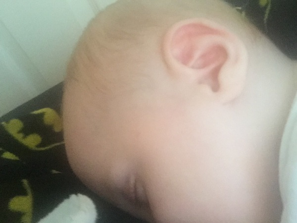 To not give my 6 month olds squash?