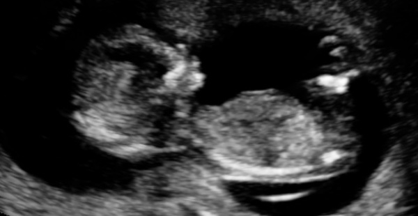 MAY 2017 #3 - Scans and plans !