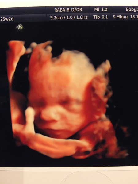 Due in February 2017 - thread #9