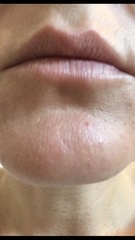 Help with my skin you experts (pics included)