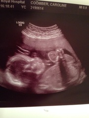 Boy or girl - help me guess!!