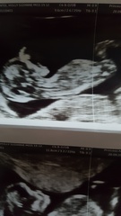 Have a guess!? Boy or girl?