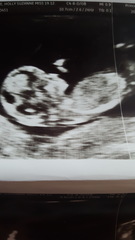 Have a guess!? Boy or girl?