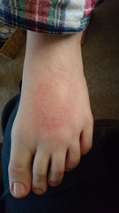 What is this on DD'S foot? Picture included
