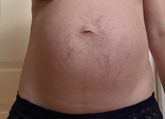 If you didn't get stretch marks with your 1st and 2nd - did you get some with your 3rd?