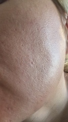 Help with my skin you experts (pics included)