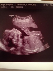 Boy or girl - help me guess!!