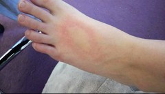 What is this on DD'S foot? Picture included