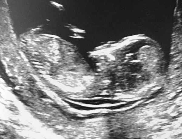 Calling all gender guessing experts please!!