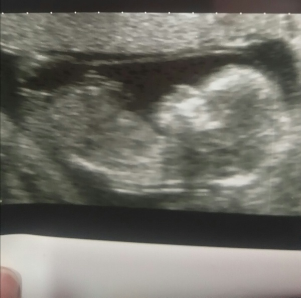 Nub gender guesses please!