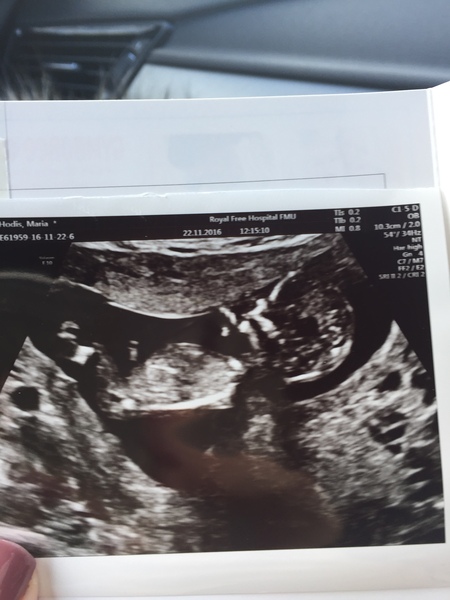 Nub gender guesses please!