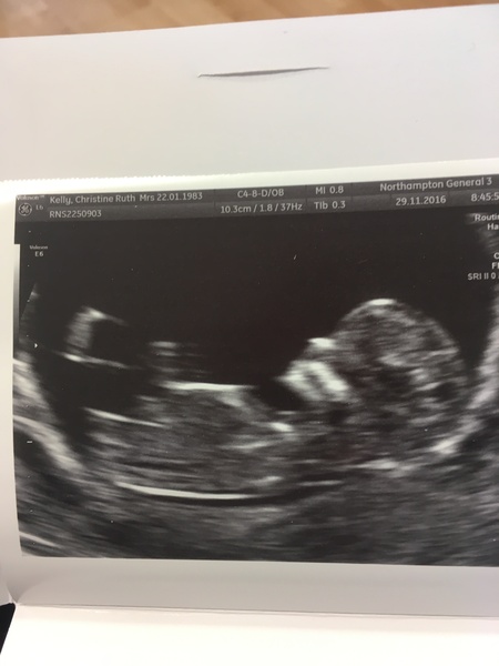 Due in June, 12 week scans happening and coming up!