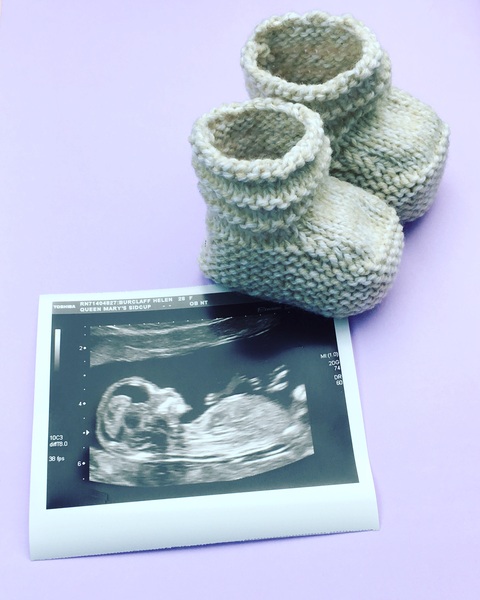 How did you announce your pregnancy?