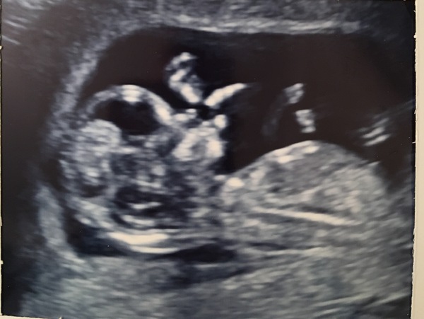 MAY 2017 #3 - Scans and plans !