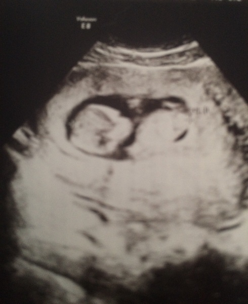 Nub gender guesses please!