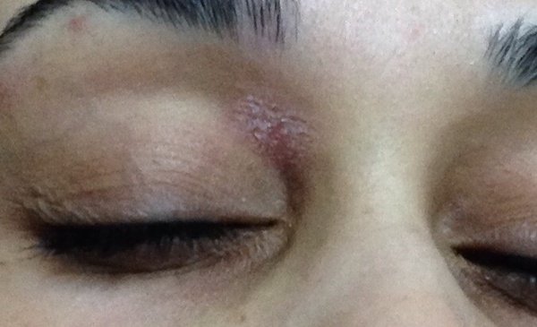 What is this and how do I fix it? (Dry patch of skin)