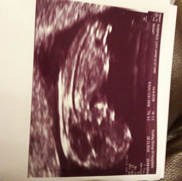 Due in June, 12 week scans happening and coming up!