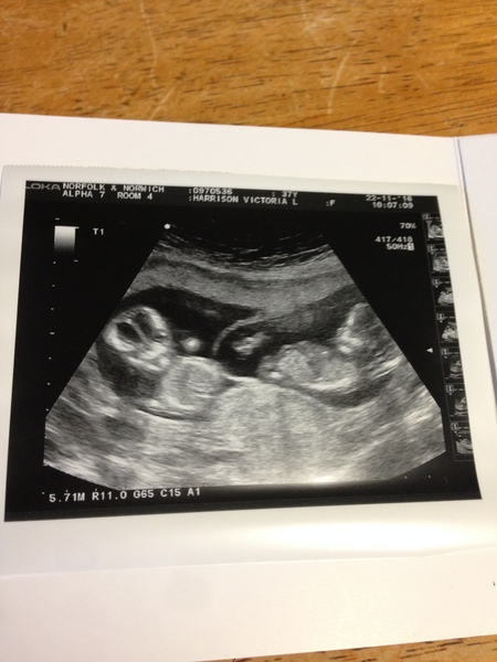 When did you find out it was more than one??