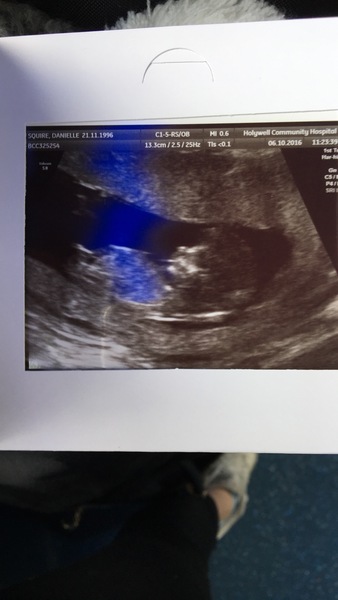 Boy or Girl
