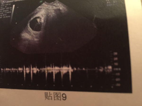 Anyone had a scan at 6 weeks