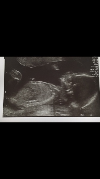 Please can someone guess the gender?