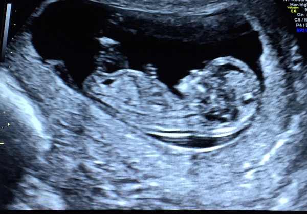 MAY 2017 #3 - Scans and plans !