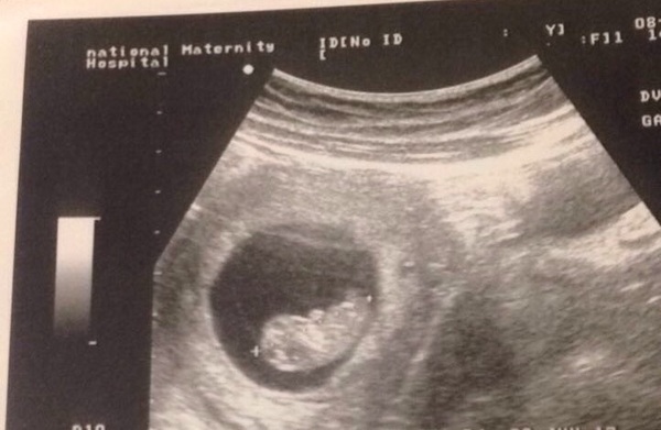 MAY 2017 #3 - Scans and plans !