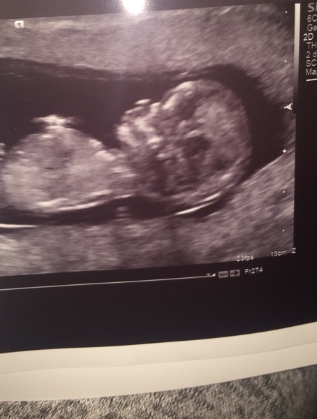 MAY 2017 #3 - Scans and plans !