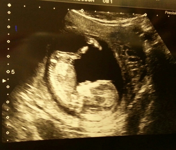 MAY 2017 #3 - Scans and plans !