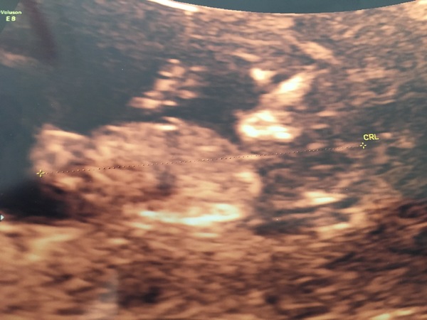 MAY 2017 #3 - Scans and plans !