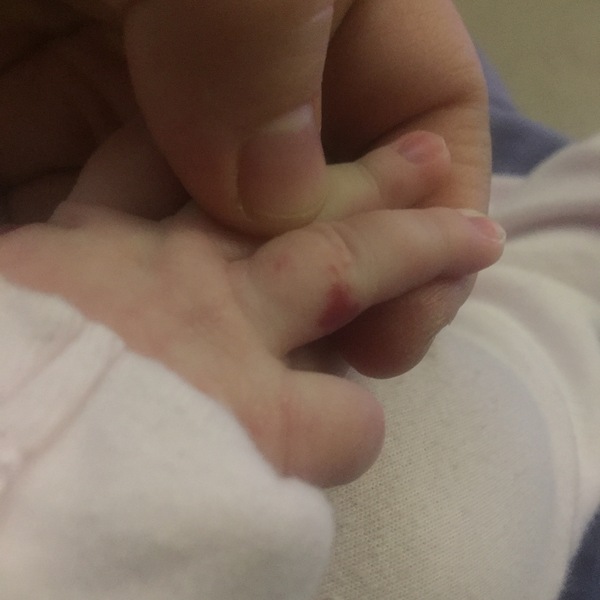 PFB alert! Is this anything? (photo)