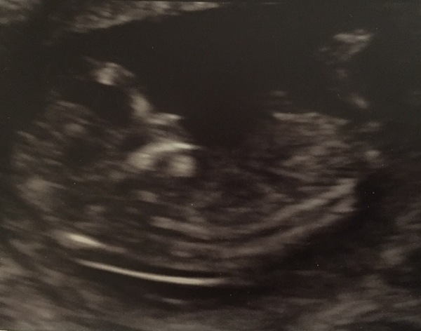 MAY 2017 #3 - Scans and plans !