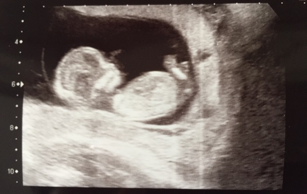 MAY 2017 #3 - Scans and plans !