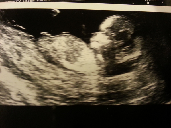 Nub gender guesses please!
