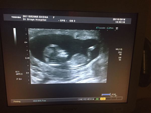 MAY 2017 #3 - Scans and plans !