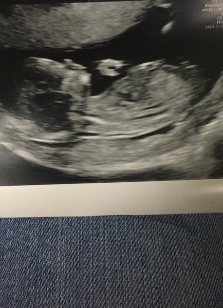 MAY 2017 #3 - Scans and plans !