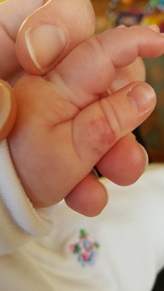PFB alert! Is this anything? (photo)