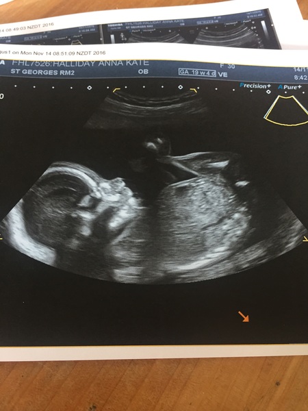 April 2017 #5 - second trimester! Less feeling crap, more feeling kicks