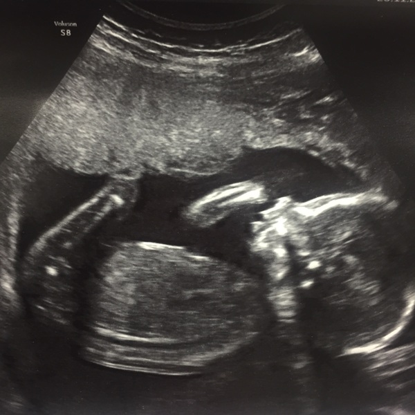 April 2017 #5 - second trimester! Less feeling crap, more feeling kicks