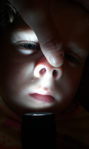 What's this in daughters nose?