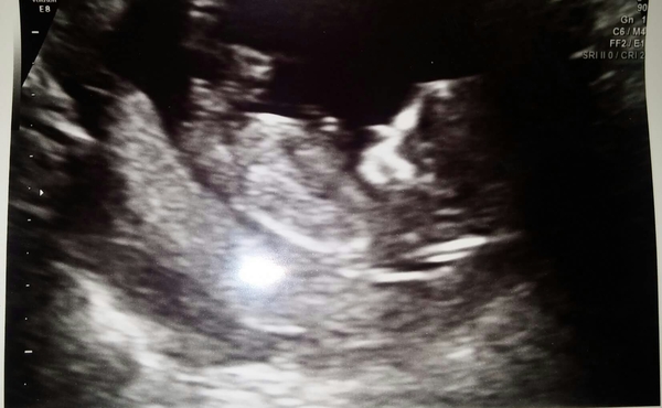 12 week scan in two hours...