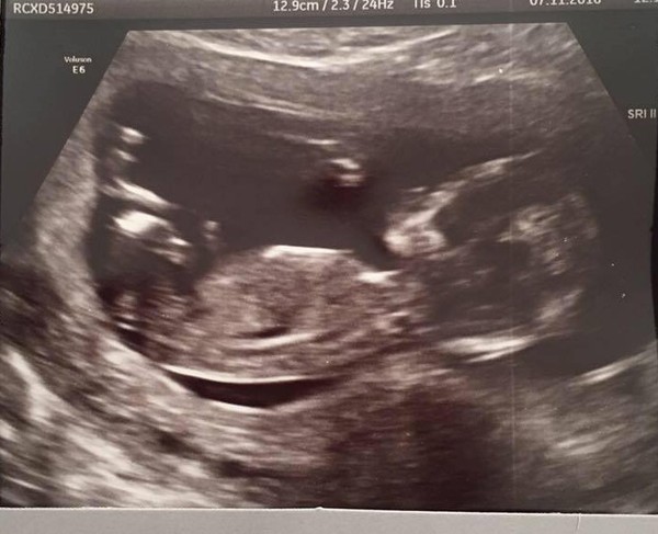 13weeks 2 day scan picture anyone guess the gender