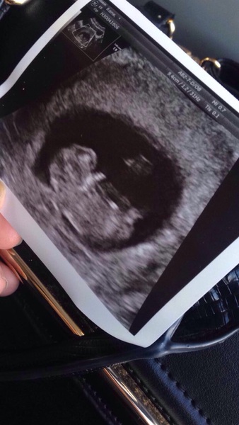 MAY 2017 #3 - Scans and plans !