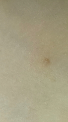 What is this and should I visit the GP?
