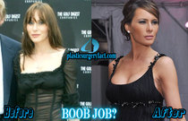 That tight glowy poreless Melania/Kardashian skin... how on earth do you get it?
