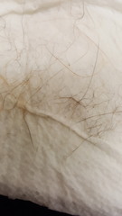 Any flea experts...confused?