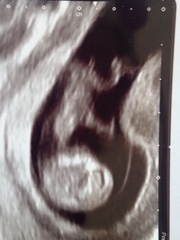 Gender scan this Saturday- anyone fancy a guess?