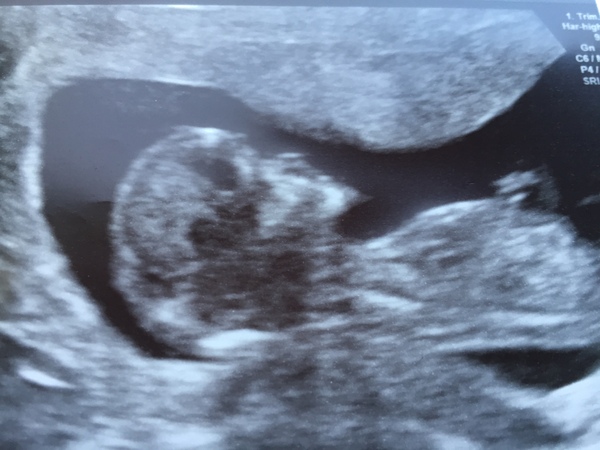 Due in June, 12 week scans happening and coming up!